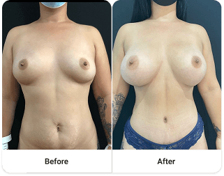 Before and after 7
